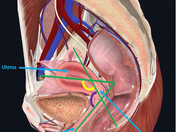 course image